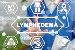 a man in a blue suit is touching the word lymphedema